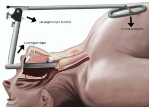 Laryngoscope